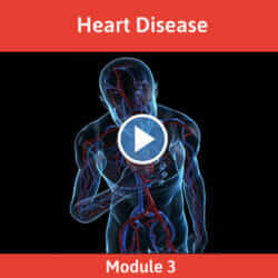 Module 3 - Heart Disease